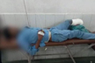 Man’s severed leg used as pillow at govt medical college in UP, probe ordered